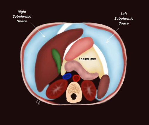 MRIOnline Imaging Mastery Series: Peritoneum and Mesentery 2021