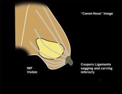 MRIOnline Imaging Mastery Series: Regulatory/Standards of Care in Breast Imaging 2021