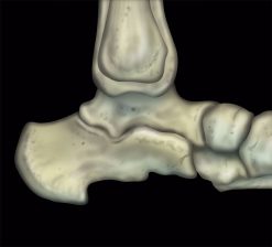 MRIOnline MRI Mastery Series: Ankle 2017
