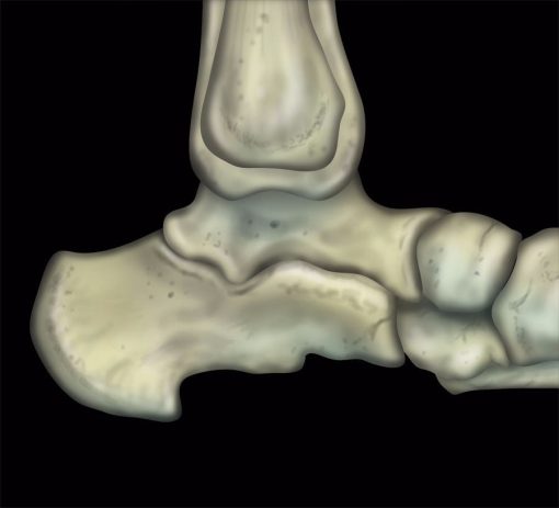 MRIOnline MRI Mastery Series: Ankle 2017