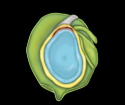 MRIOnline MRI Mastery Series: SLAP Lesions 2020