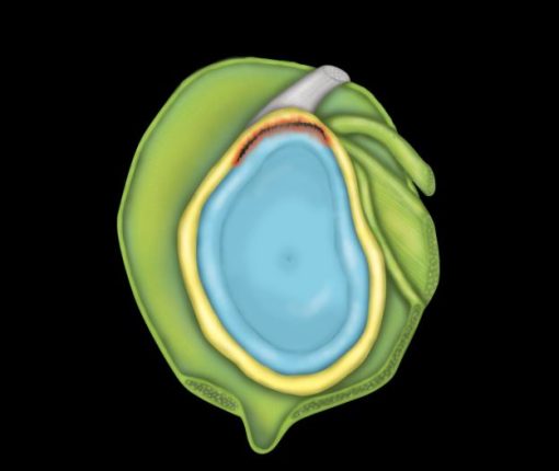 MRIOnline MRI Mastery Series: SLAP Lesions 2020