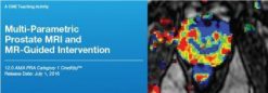 Multi-Parametric Prostate MRI and MR-Guided Intervention 2016 (Videos) | Medical Video Courses.