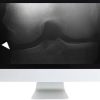 ARRS Musculoskeletal Imaging for the Practicing Radiologist 2018 | Medical Video Courses.