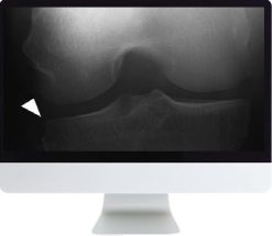 ARRS Musculoskeletal Imaging for the Practicing Radiologist 2018 | Medical Video Courses.