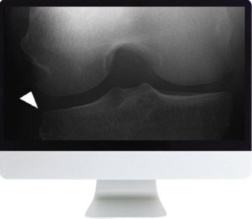 ARRS Musculoskeletal Imaging for the Practicing Radiologist 2018 | Medical Video Courses.