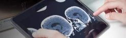Neuroradiology Update 2016 – Online