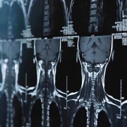 Neurosurgery – A Comprehensive Review 2021 | Medical Video Courses.