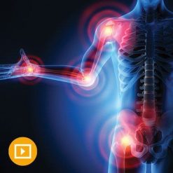 The Brigham Board Review and Comprehensive Update in Rheumatology 2022