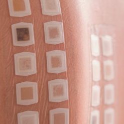 The Brigham Board Review in Allergy and Immunology 2021 | Medical Video Courses.