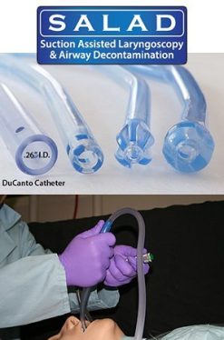 The SALAD Technique Suction-Assisted Laryngoscopy (with simultaneous) Airway Decontamination