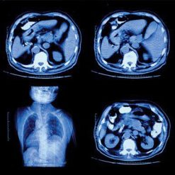 UCSF Abdominal and Thoracic Imaging 2022