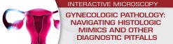 USCAP Gynecologic Pathology: Navigating Histologic Mimics and Other Diagnostic Pitfalls 2021