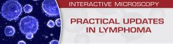 USCAP Practical Updates in Lymphoma 2018 | Medical Video Courses.
