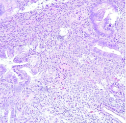Gynecologic Pathology: Masters of Pathology Series 2026 (Videos + PDF)