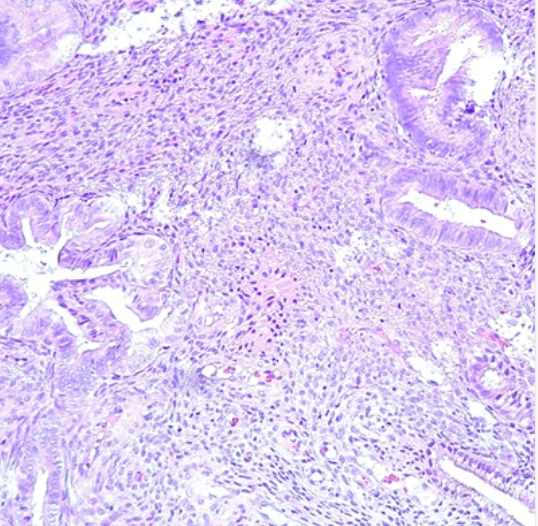 Gynecologic Pathology: Masters of Pathology Series 2026 (Videos + PDF)