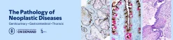 MSKCC The Pathology of Neoplastic Diseases 2026