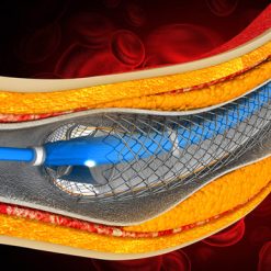 Oakstone Comprehensive Review and Update of What’s New in Vascular and Endovascular Surgery 2025