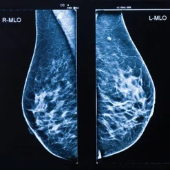 Oakstone UCSF Breast Imaging 2026